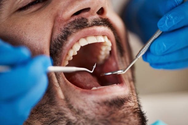 Best Broken or Chipped Tooth Repair in South Gate Ridge, FL